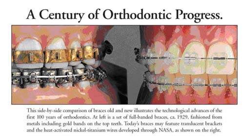 orthodontics history bellevue wa